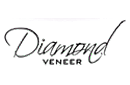 Diamond Veneer返现比较与奖励比较